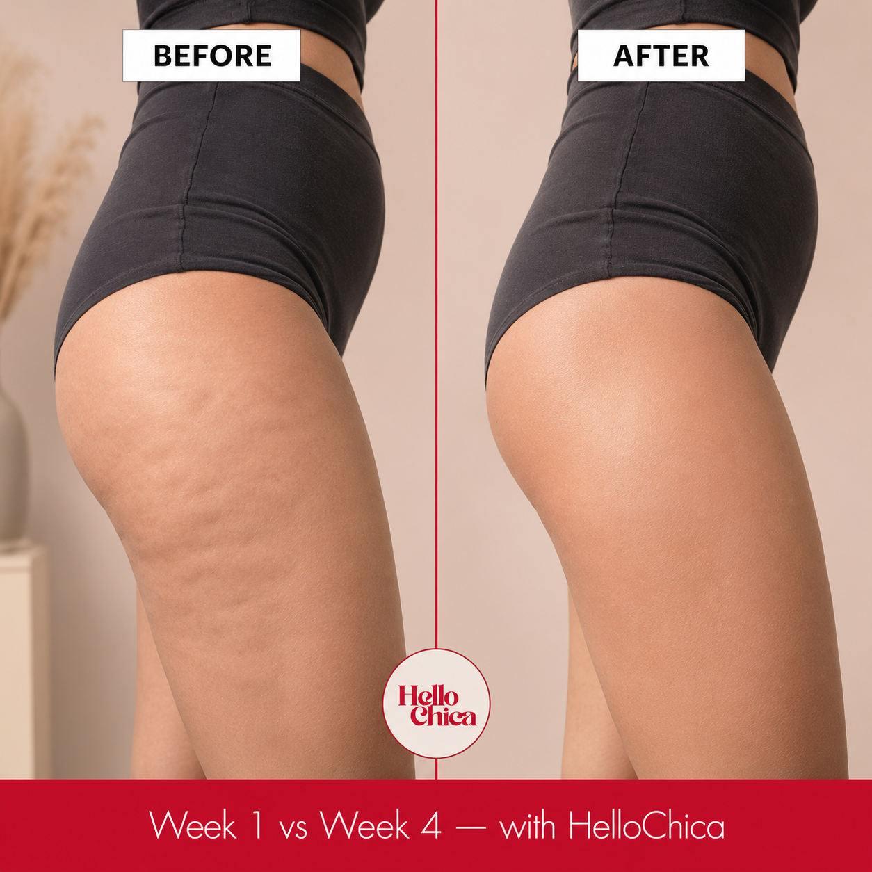 HelloChica Cellulite & Lymphatic Drainage Massager