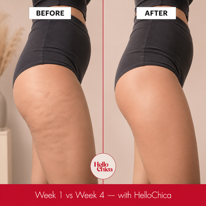 HelloChica Cellulite & Lymphatic Drainage Massager